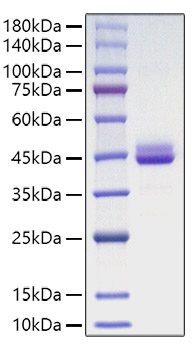 Recombinant Human CD9 Protein