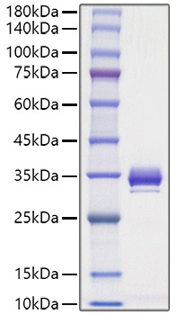 Recombinant Mouse Angiopoietin-1/ANG-1/ANGPT1(277-498) Protein