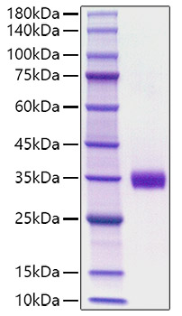 Recombinant Mouse Angiopoietin-2/ANG-2/ANGPT2(275-496) Protein