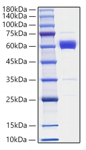 Recombinant Mouse IL-19  Protein