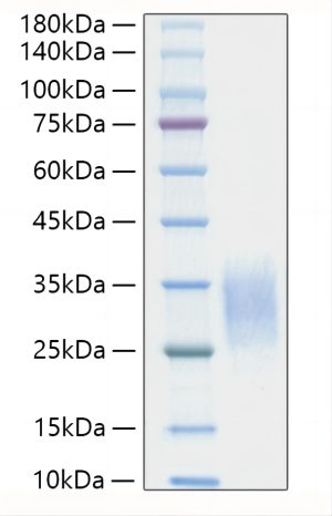 Recombinant Mouse IL-19 Protein