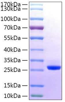 Recombinant Human BTN3A2 Protein