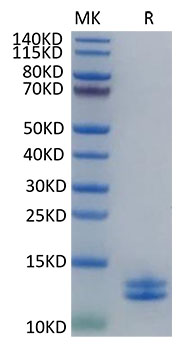 Recombinant Human Calgranulin-A&Calgranulin-B/S100A8&S100A9 Protein