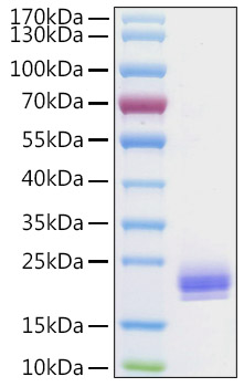 Recombinant Human Lymphotactin/XCL1 Protein