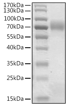 Recombinant Human Angiopoietin-like 8/ANGPTL8 (22-198) Protein