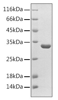 Recombinant Mouse Sclerostin/SOST Protein