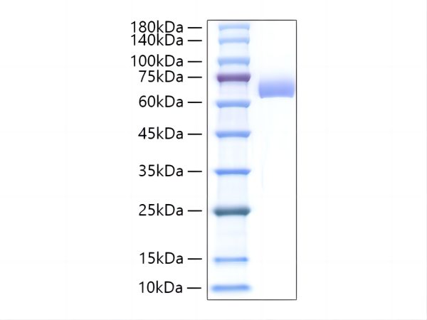 Recombinant Mouse Alkaline phosphatase (Intestinal type)/ALPI Protein