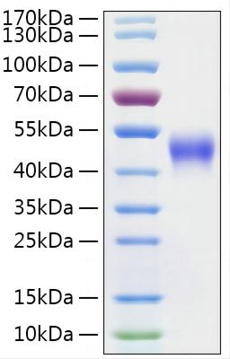 Recombinant Mouse IL-2 R beta/CD122 Protein