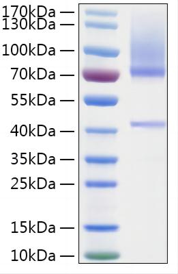 Recombinant Human HGF Activator/HGFA Protein