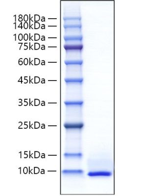 Recombinant Mouse CXCL5/ENA-70 Protein