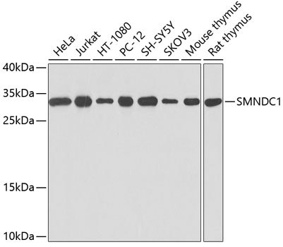 SMNDC1 Rabbit pAb