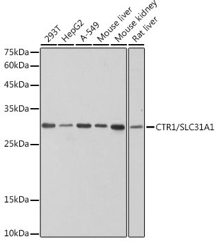 CTR1/SLC31A1 Rabbit mAb