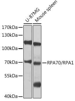 RPA70/RPA1 Rabbit pAb