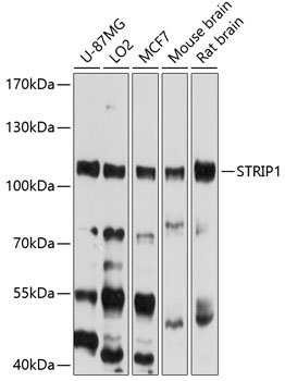 STRIP1 Rabbit pAb
