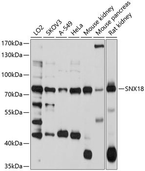 SNX18 Rabbit pAb