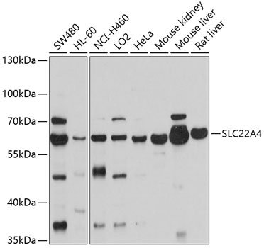 SLC22A4 Rabbit pAb