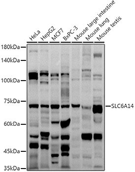 SLC6A14 Rabbit pAb