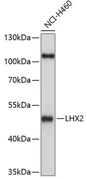 LHX2 Rabbit pAb