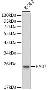 RAB7 Rabbit pAb