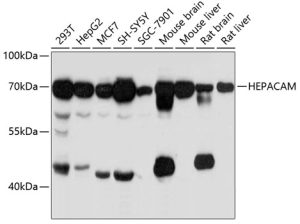 HEPACAM Rabbit pAb