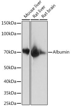 Albumin Rabbit mAb