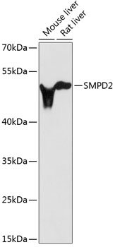 SMPD2 Rabbit pAb