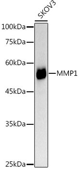 MMP1 Rabbit pAb