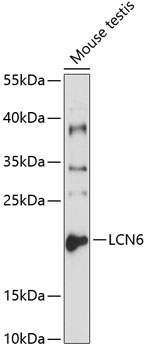 LCN6 Rabbit pAb