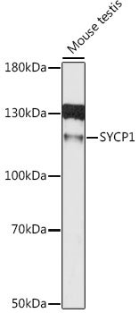 SYCP1 Rabbit pAb