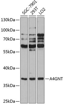 A4GNT Rabbit pAb