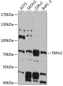 TRPV2 Rabbit pAb