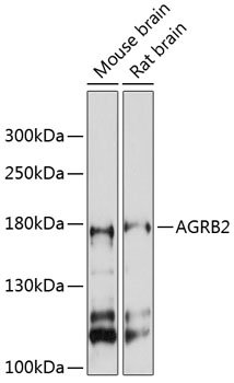 AGRB2 Rabbit pAb