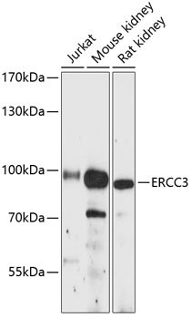 ERCC3 Rabbit pAb