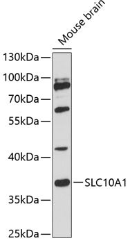 SLC10A1 Rabbit pAb