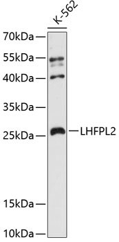 LHFPL2 Rabbit pAb
