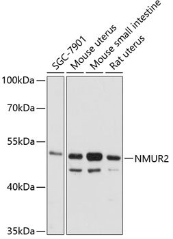 NMUR2 Rabbit pAb