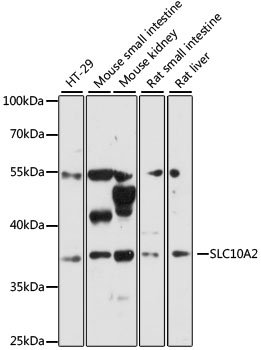 SLC10A2 Rabbit pAb