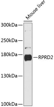 RPRD2 Rabbit pAb