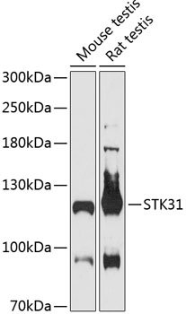 STK31 Rabbit pAb