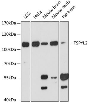 TSPYL2 Rabbit pAb