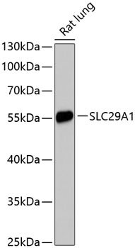SLC29A1 Rabbit pAb