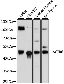ACTR6 Rabbit pAb