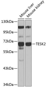 TESK2 Rabbit pAb