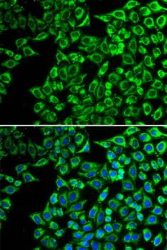 LIPC Rabbit pAb