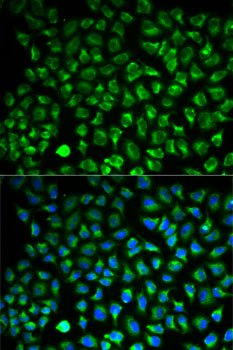 Monoamine Oxidase A (MAOA) Rabbit pAb
