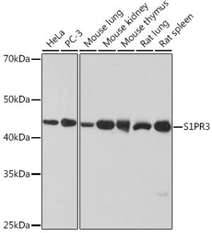 S1PR3 Rabbit mAb