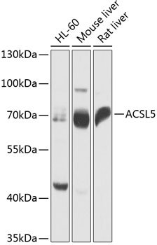 ACSL5 Rabbit pAb