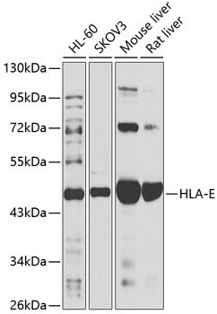 HLA-E Rabbit pAb