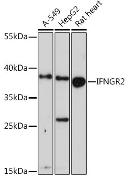 IFNGR2 Rabbit pAb