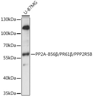PP2A-B56β/PR61β/PPP2R5B Rabbit pAb